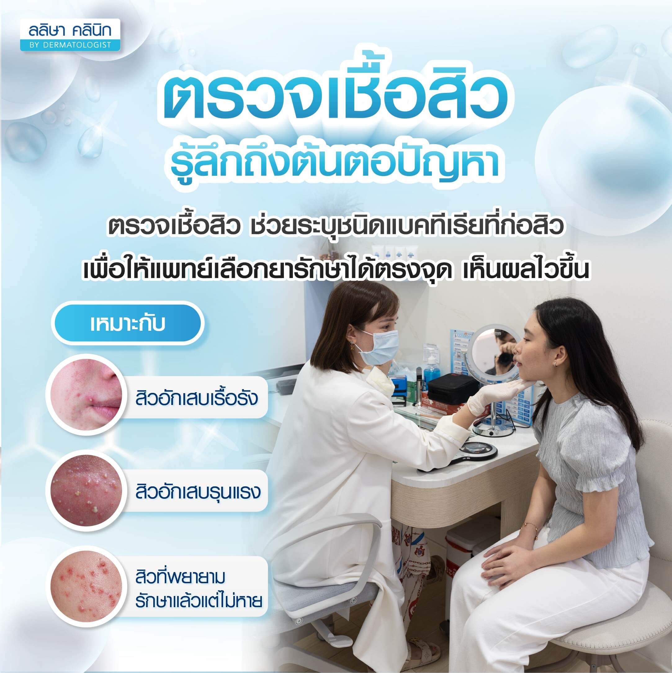 ตรวจเชื้อสิว