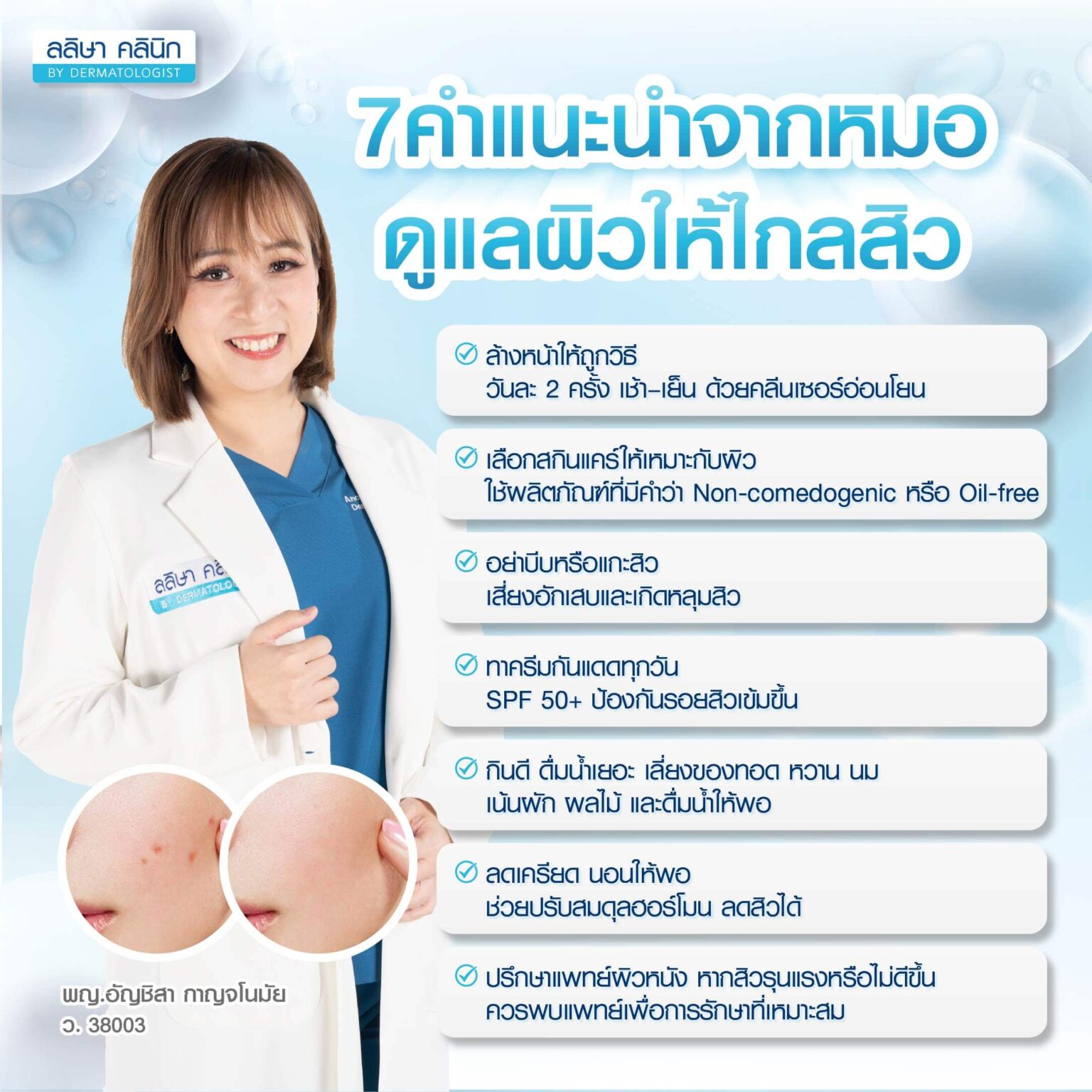 หมอรักษาสิว