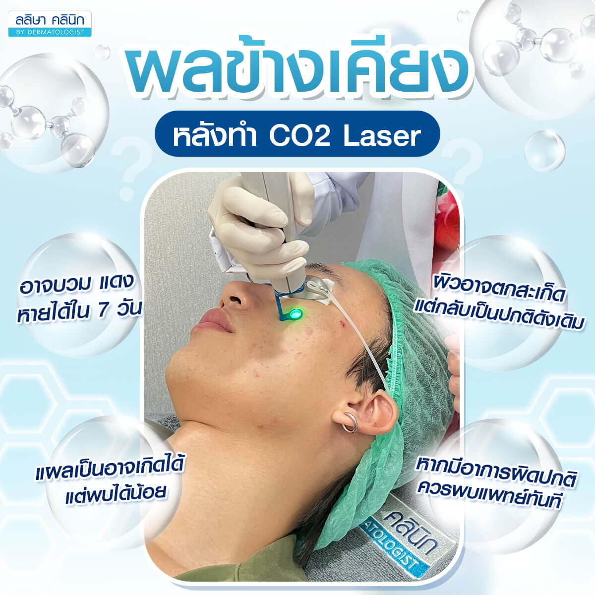 ผลข้างเคียงหลังทำ CO2 Laser