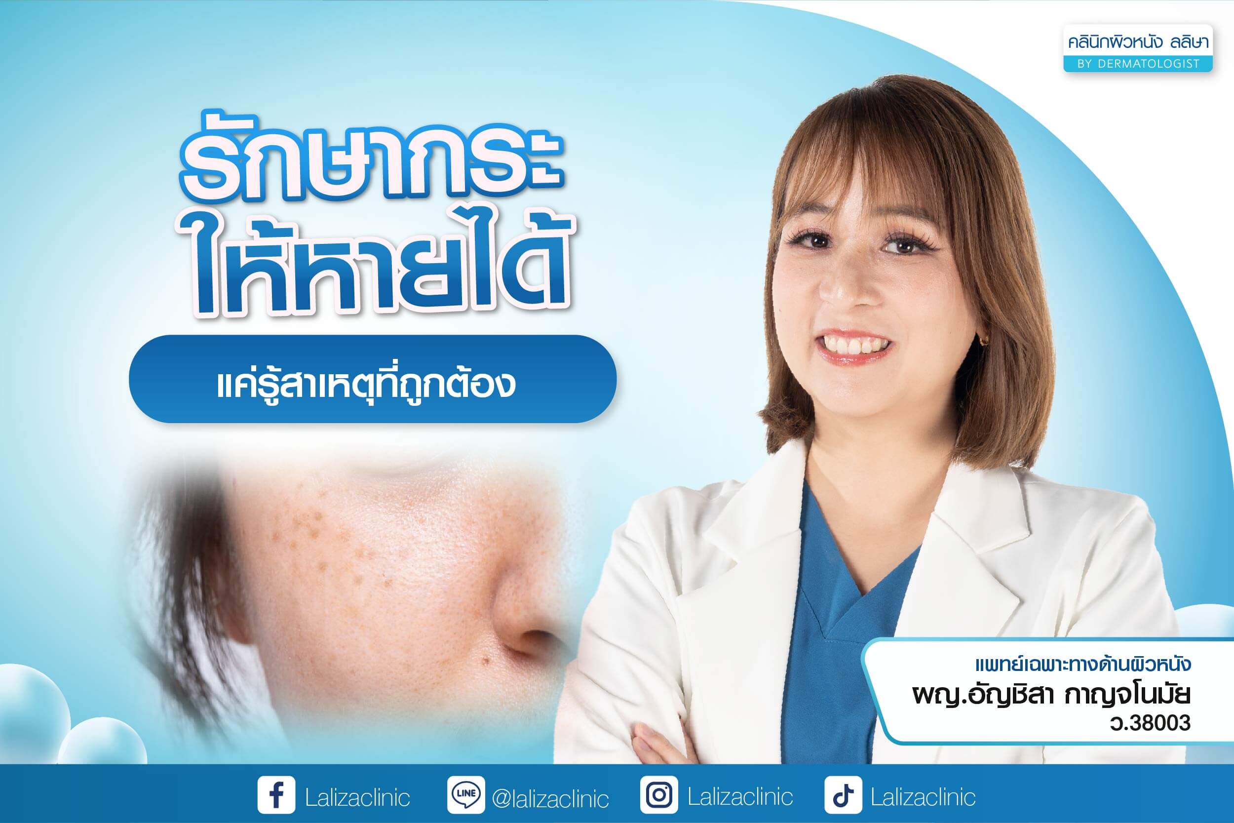 รักษากระ บนใบหน้า