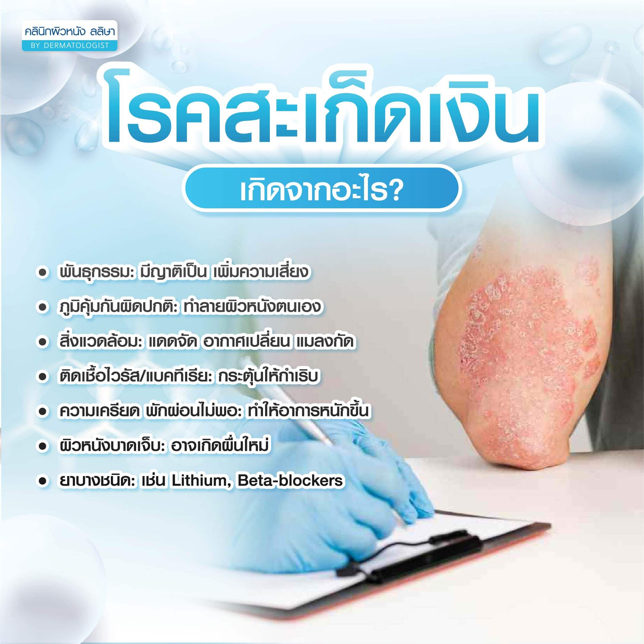 สะเก็ดเงิน เกิดจากสาเหตุ