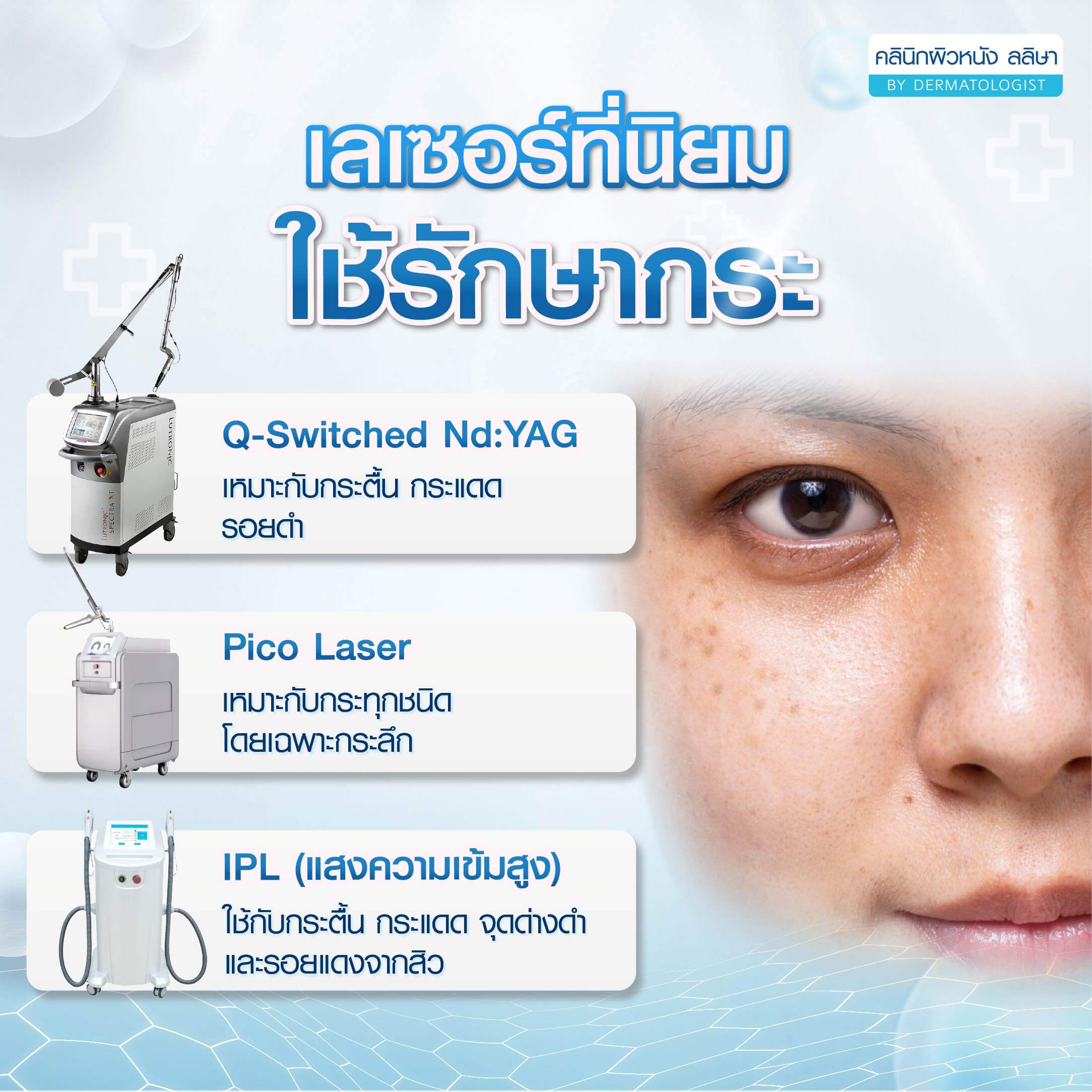 เลเซอร์ที่ใช้รักษากระ เป็นแบบไหน